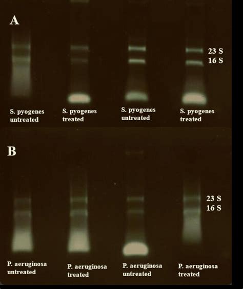 cytanol|Agarose Gel Electrophoresis of RNA .